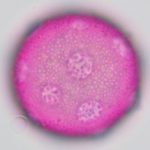 a dark pink stained pollen with several pores