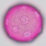 a dark pink stained pollen with several pores
