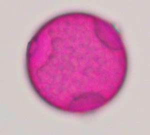 A round pollen of Celits with three aspidate pores equidistance from each other.