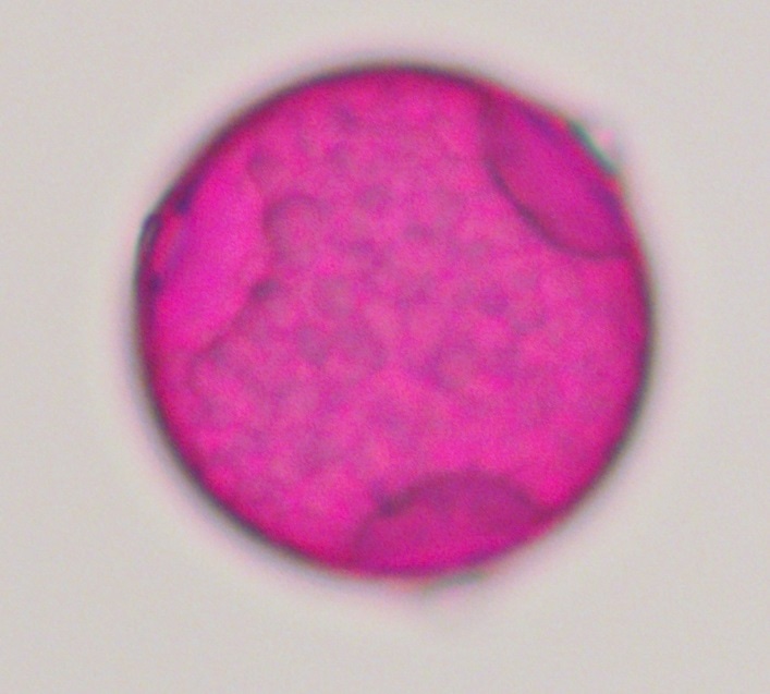 Celtis/Hackberry Pollen