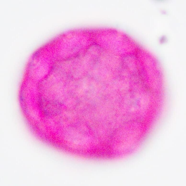 A irregular round pink sshaped pollen with eight annulate pores.