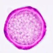 a pentagonal shaped pollen, fuchsin stained with granules visible in the body.
