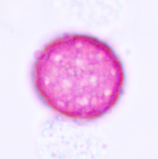 Chenopod or Amaranthus Pollen