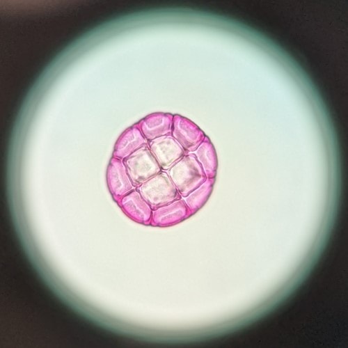 A pink colored round soccer ball like body of acacia pollen