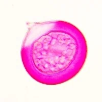 a round fuchsia stained coastal redwood pollen with a small nose like protrusion