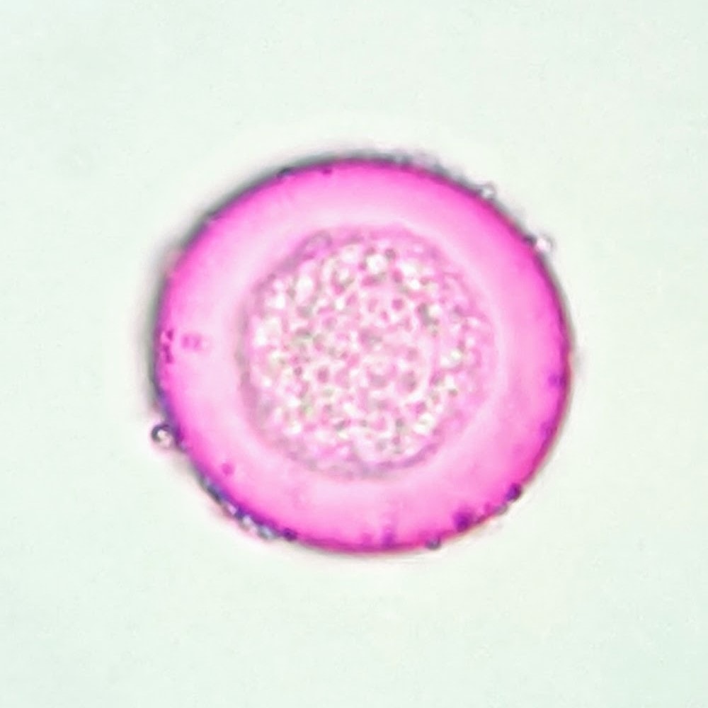 Cypress tree allergy (Cupressus) a quick guide w/ photos. » Allerma™