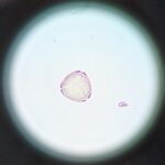 Pollen pictures of allergy plants. » Allerma™