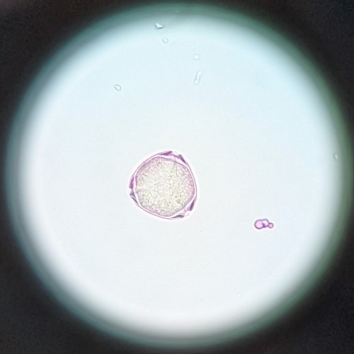 A triangular pollen or eucalyptus with three furrows