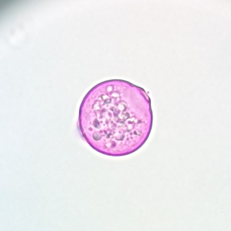 A small round pink pollen with one visible protruding pore. There is a hint of another pore on the other side , making it a total of two pores. The center mass seems granular.