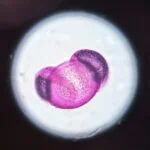 A fuchsin stained, pink looking pollen with two grey air bladders on each side