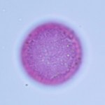 a round fuchsin stained pollen with a darker outer ring. This is what causes poplar pollen allergy when inhaled.