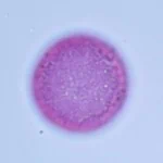 a round fuchsin stained pollen with a darker outer ring. This is what causes poplar pollen allergy when inhaled.