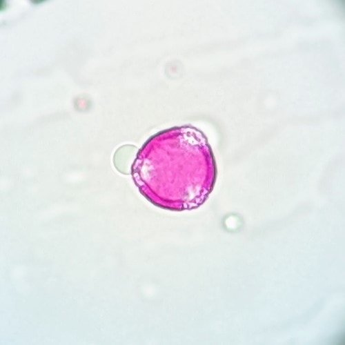 Sycamore tree allergy (Platanus) a quick guide w/ photos. » Allerma™