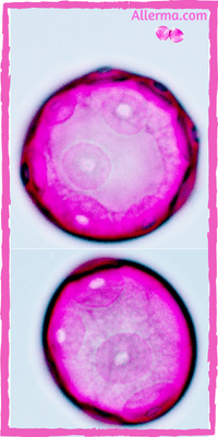 two views of walnut pollen, which shows about eight aspidate and annulate pores.